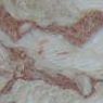 Rose Fossil